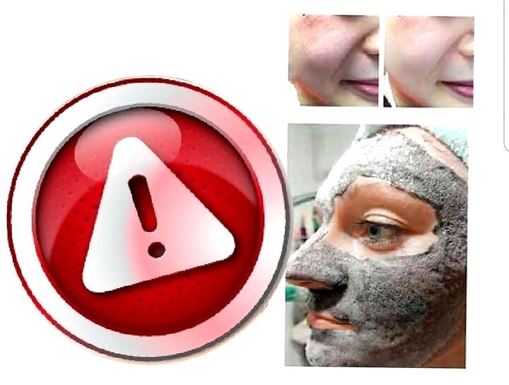 فیشیال صورت اقدام درمانی نیست 