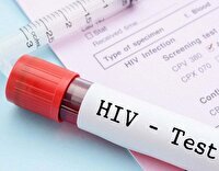 با ایدز بیشتر آشنا شویم